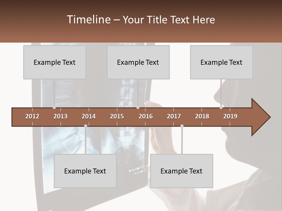 X-Ray Of The Spine PowerPoint Template