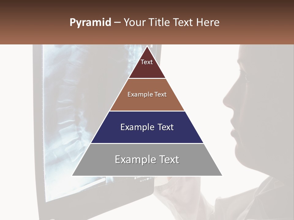 X-Ray Of The Spine PowerPoint Template