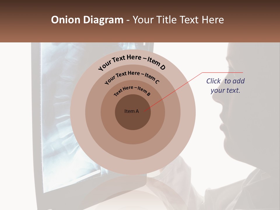 X-Ray Of The Spine PowerPoint Template