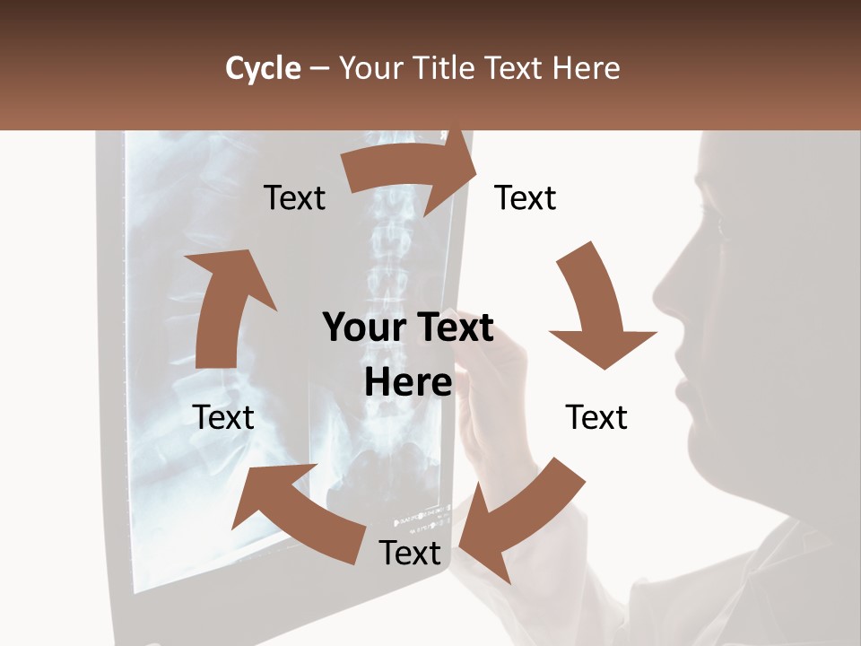 X-Ray Of The Spine PowerPoint Template