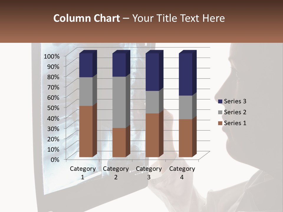 X-Ray Of The Spine PowerPoint Template
