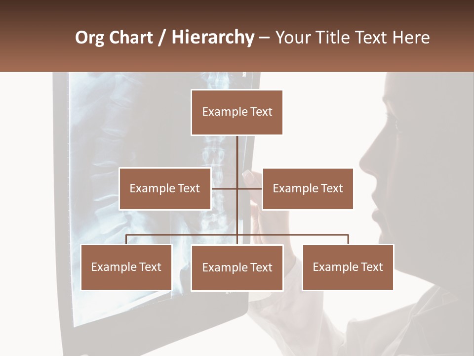 X-Ray Of The Spine PowerPoint Template