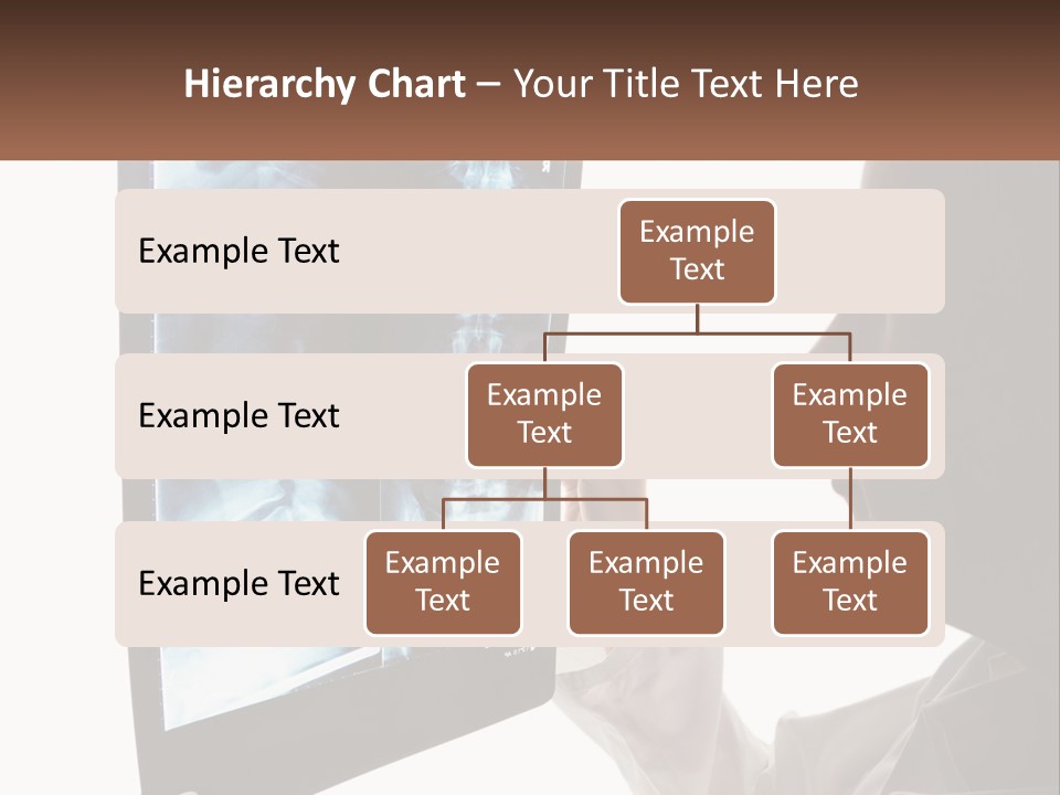 X-Ray Of The Spine PowerPoint Template