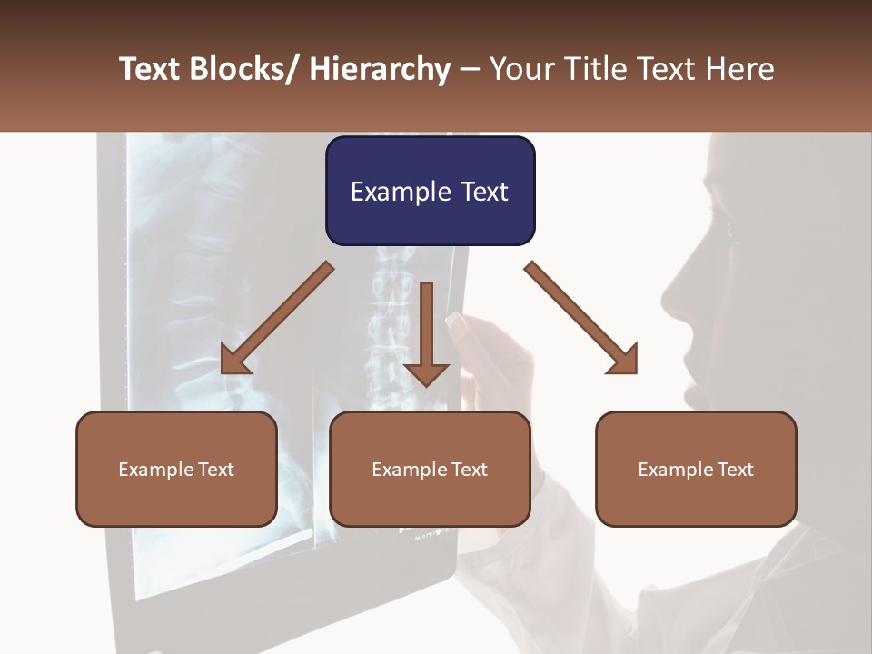 X-Ray Of The Spine PowerPoint Template