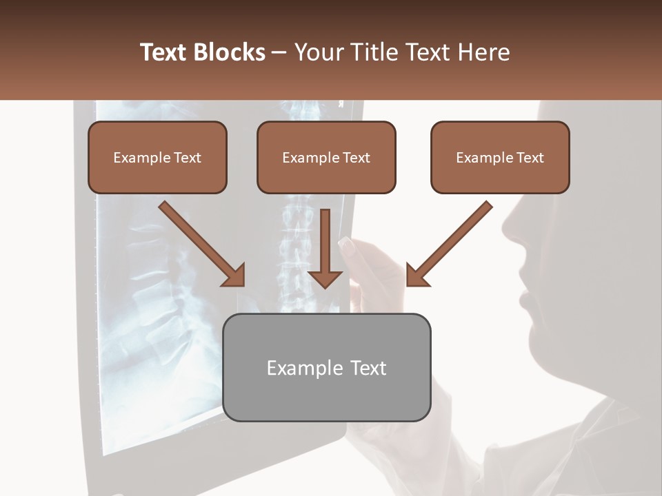 X-Ray Of The Spine PowerPoint Template