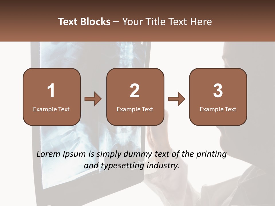 X-Ray Of The Spine PowerPoint Template