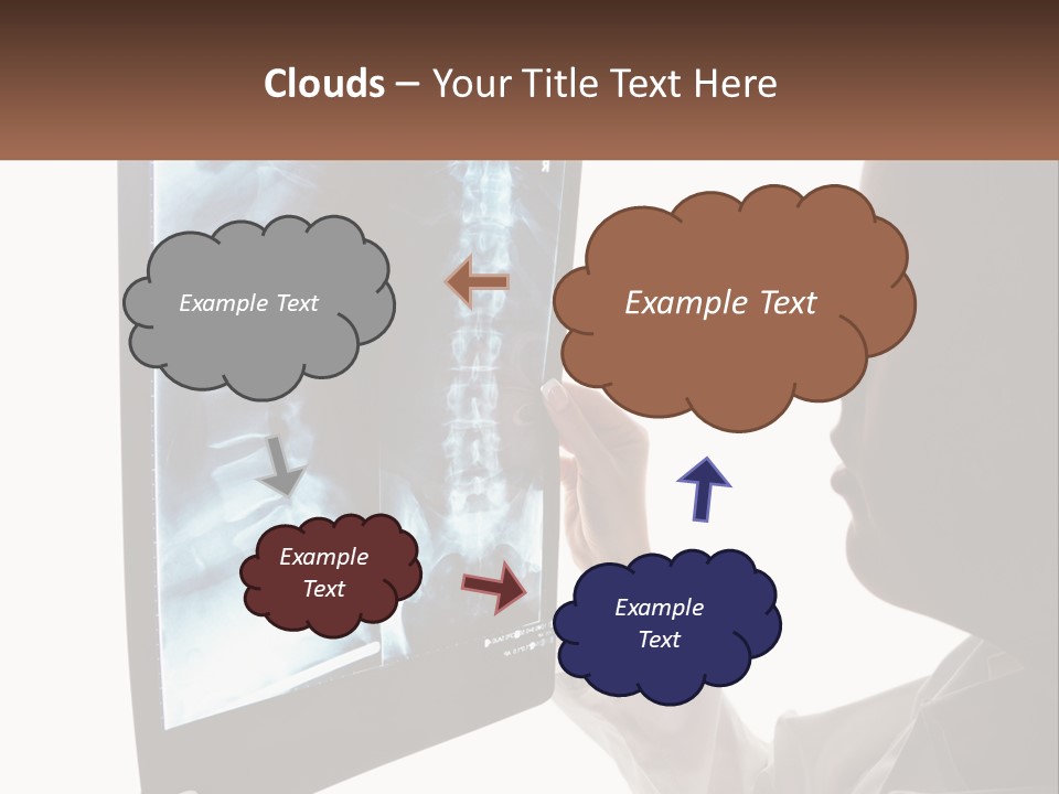 X-Ray Of The Spine PowerPoint Template