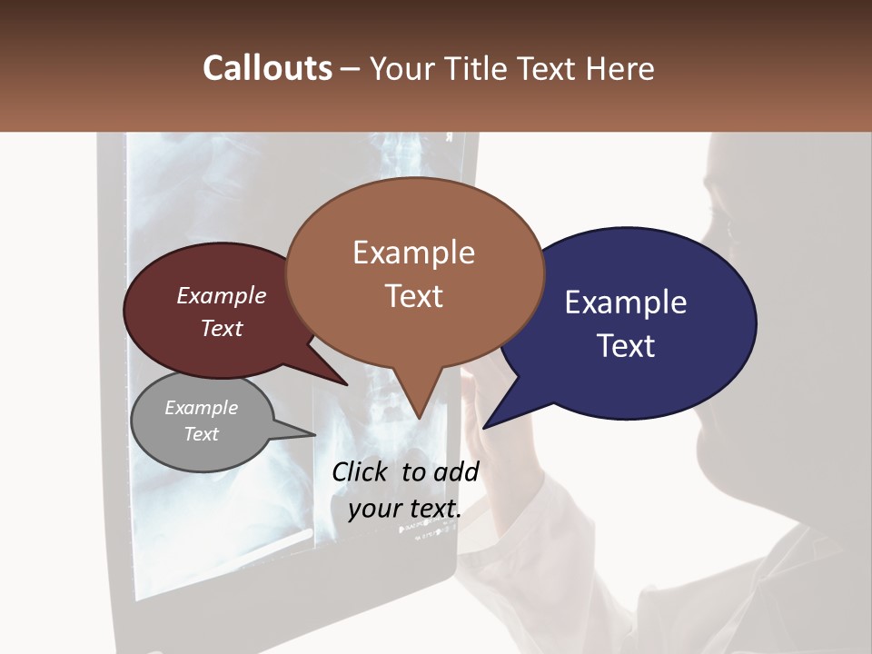 X-Ray Of The Spine PowerPoint Template