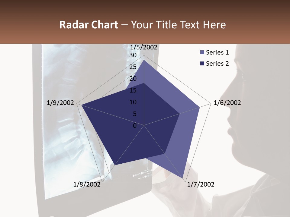 X-Ray Of The Spine PowerPoint Template