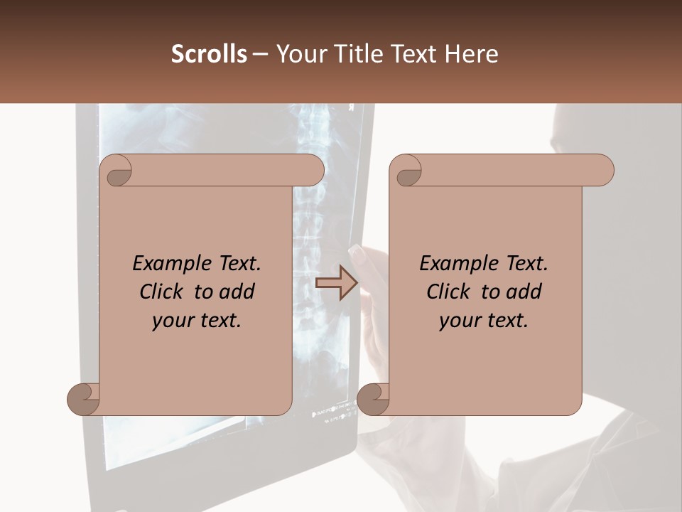 X-Ray Of The Spine PowerPoint Template