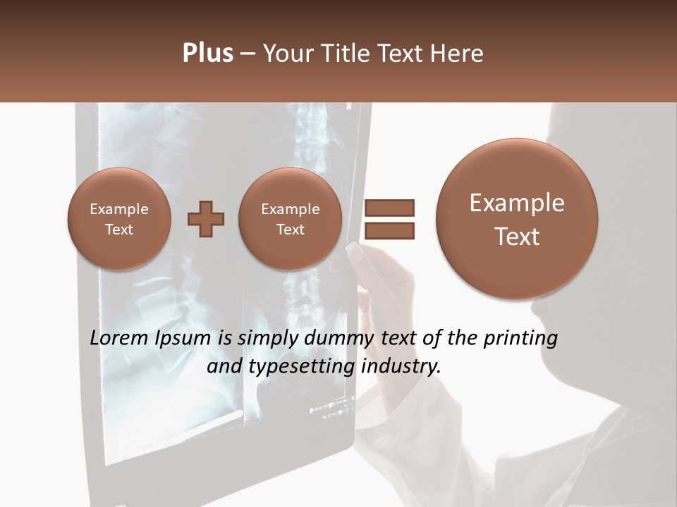 X-Ray Of The Spine PowerPoint Template