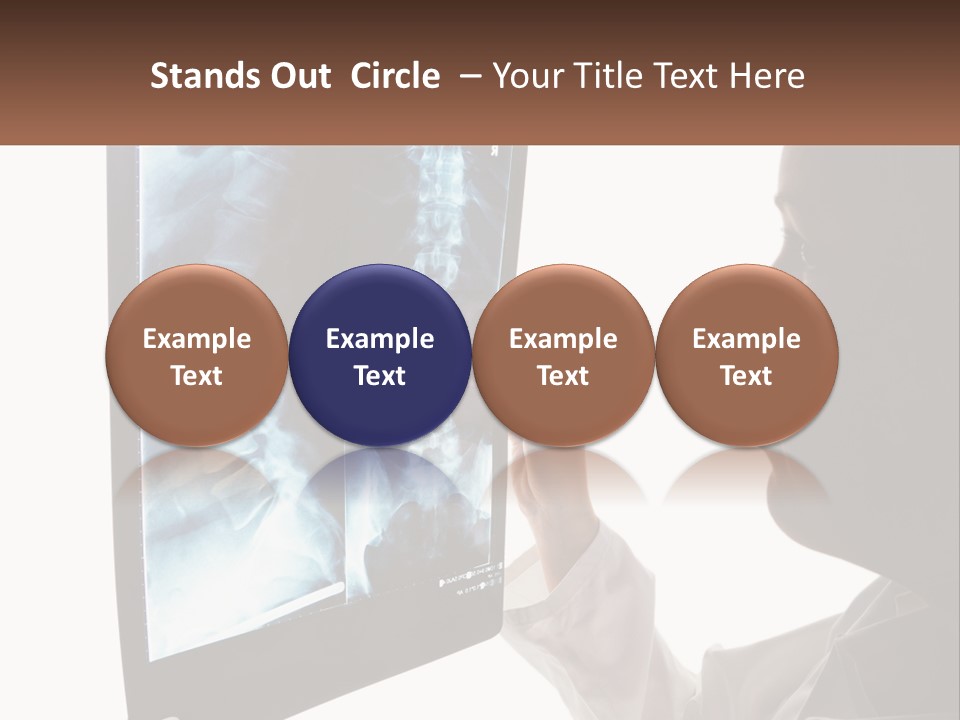 X-Ray Of The Spine PowerPoint Template