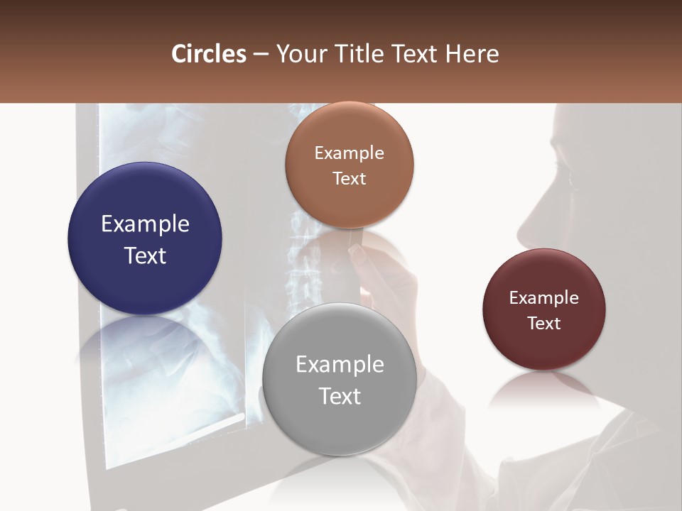 X-Ray Of The Spine PowerPoint Template