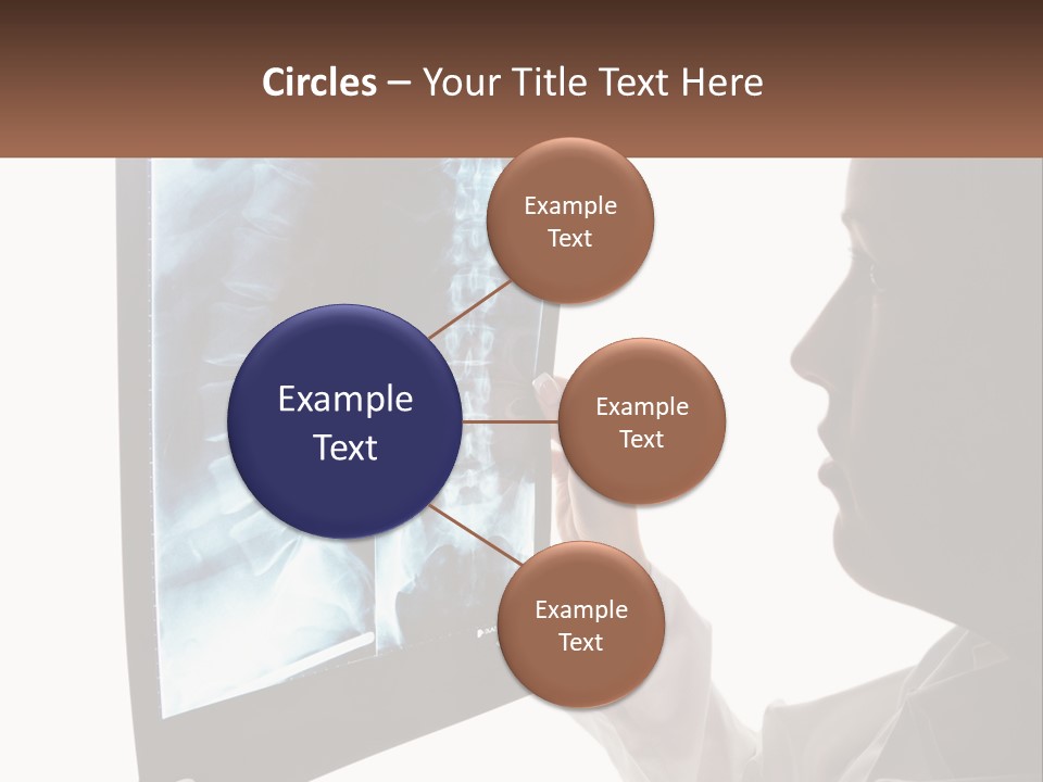 X-Ray Of The Spine PowerPoint Template