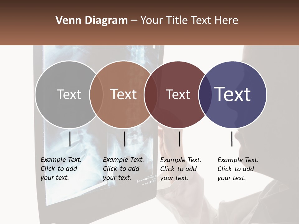X-Ray Of The Spine PowerPoint Template