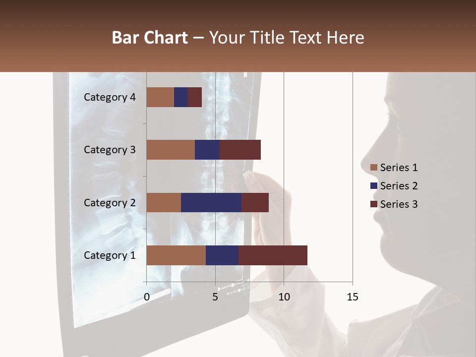 X-Ray Of The Spine PowerPoint Template