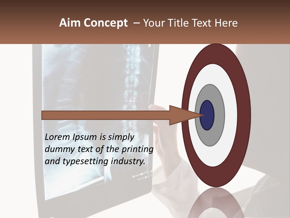 X-Ray Of The Spine PowerPoint Template