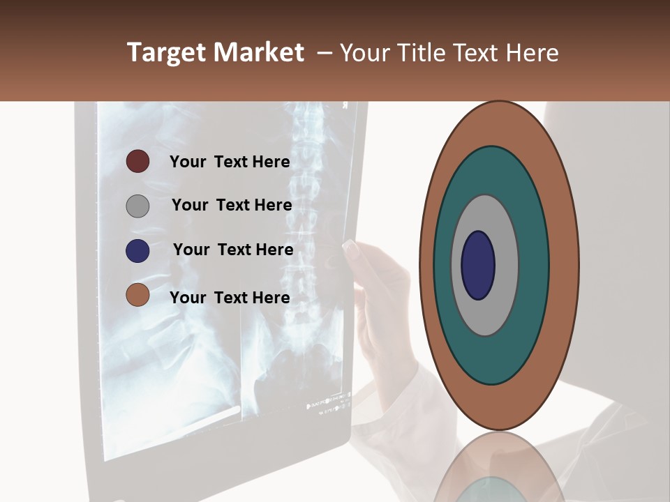 X-Ray Of The Spine PowerPoint Template