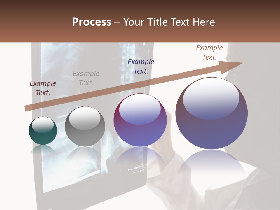 X-Ray Of The Spine PowerPoint Template