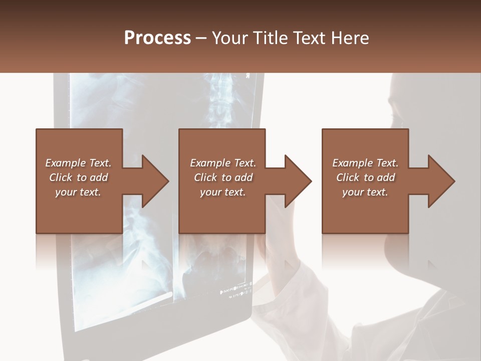 X-Ray Of The Spine PowerPoint Template
