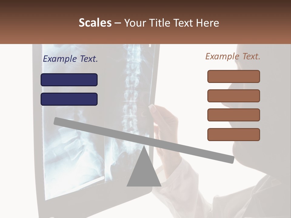 X-Ray Of The Spine PowerPoint Template