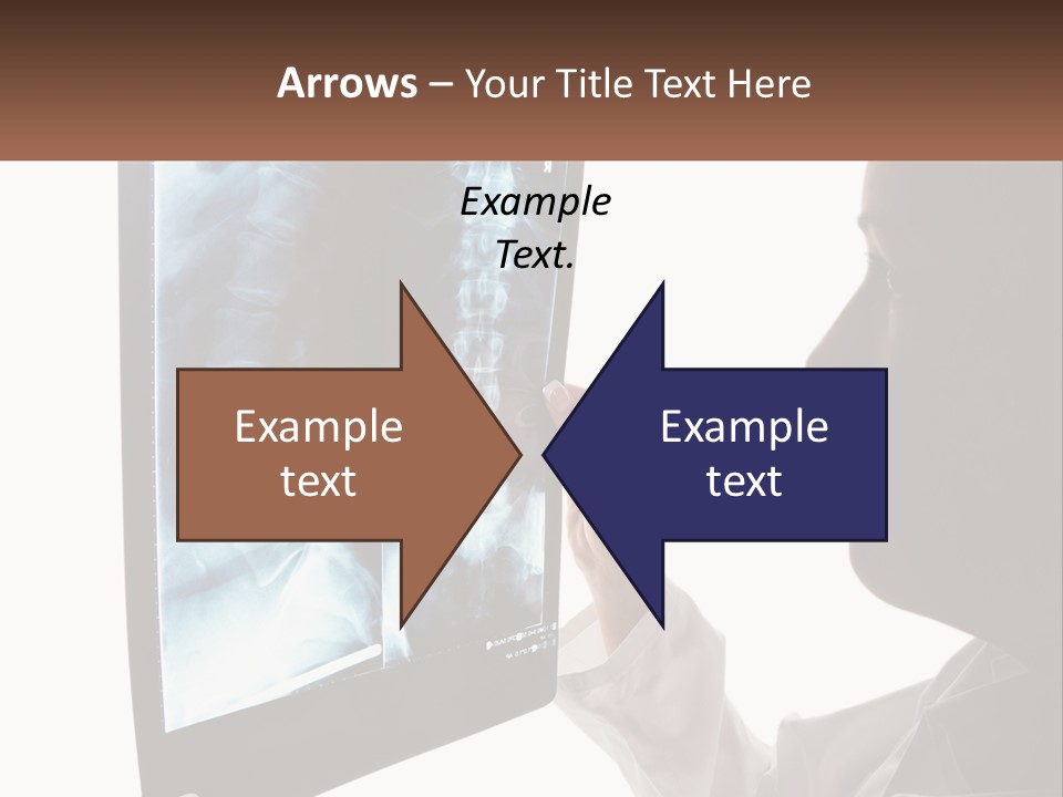 X-Ray Of The Spine PowerPoint Template