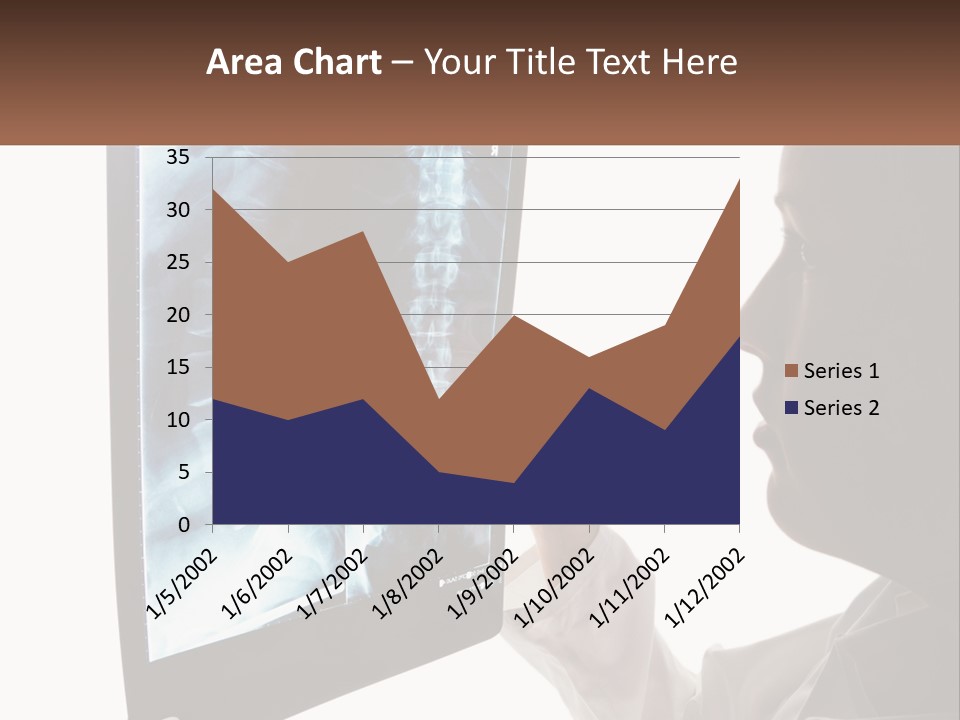 X-Ray Of The Spine PowerPoint Template
