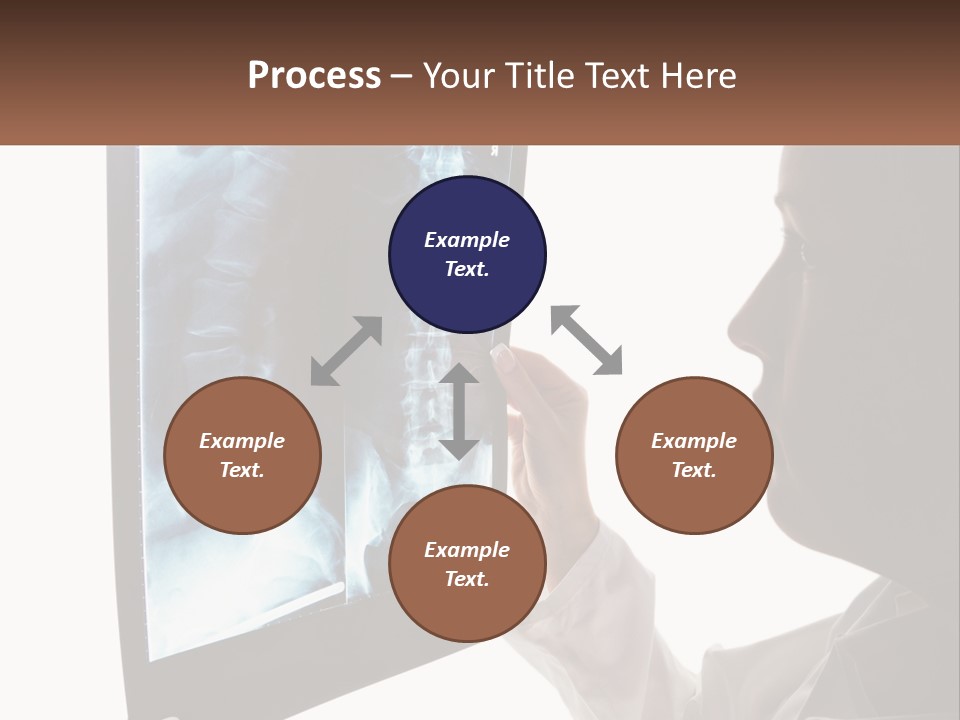 X-Ray Of The Spine PowerPoint Template