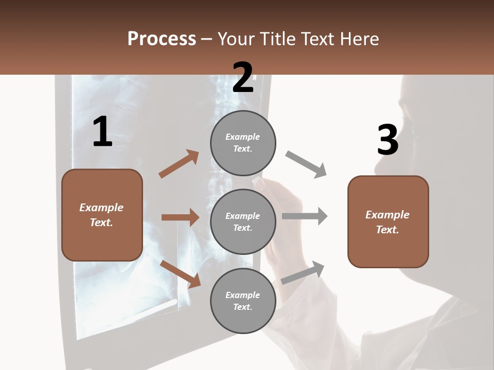 X-Ray Of The Spine PowerPoint Template