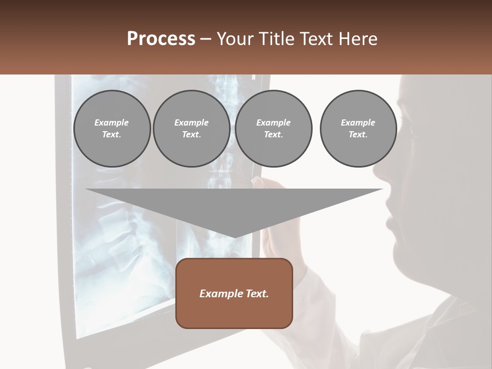 X-Ray Of The Spine PowerPoint Template