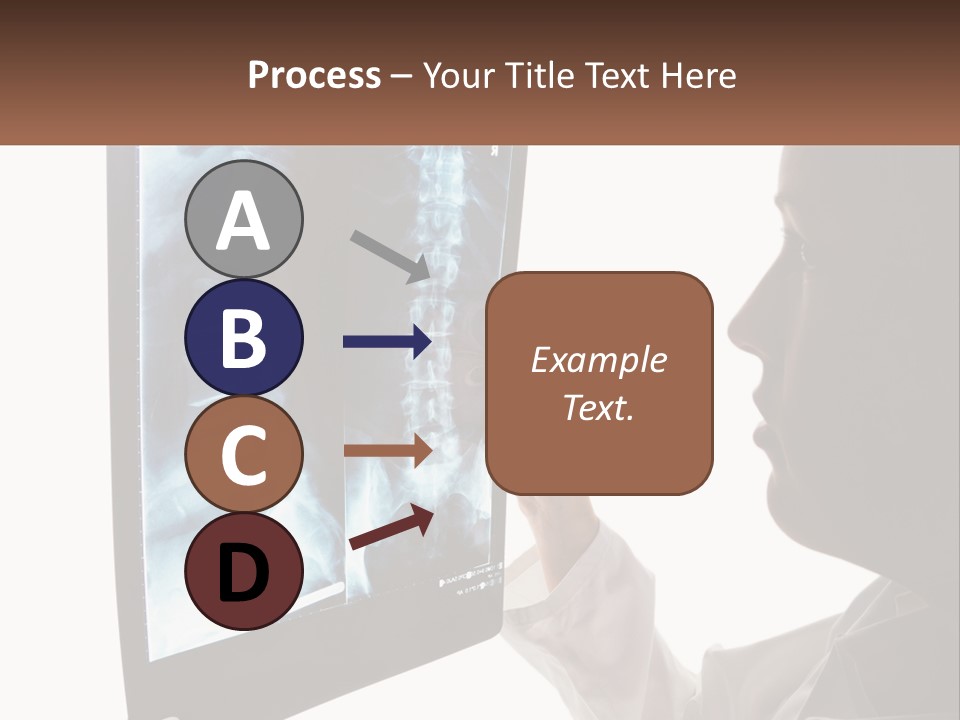 X-Ray Of The Spine PowerPoint Template