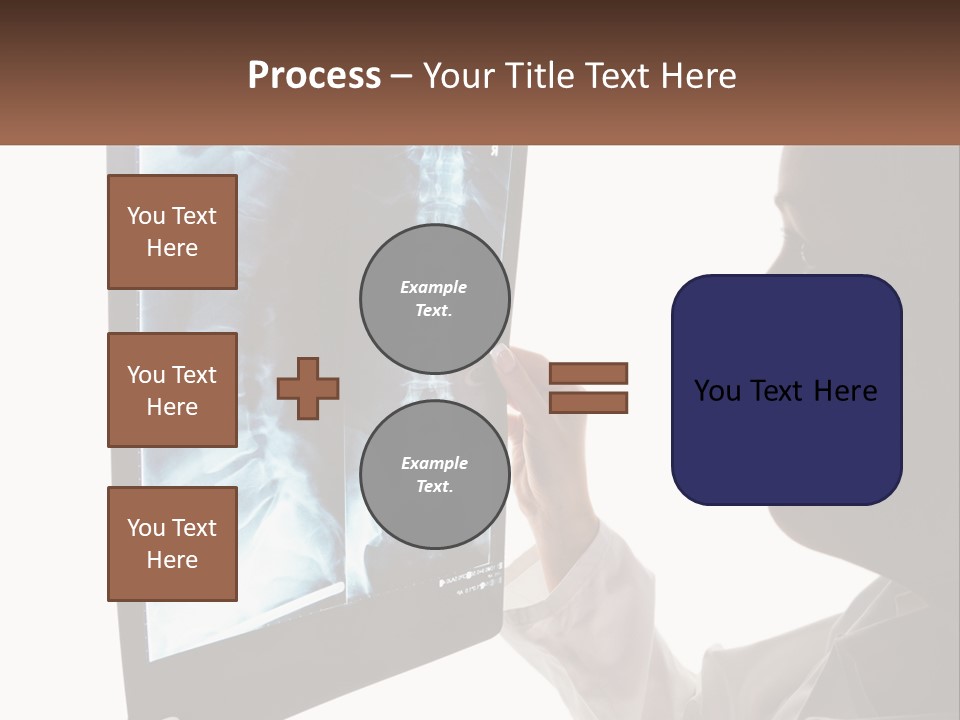 X-Ray Of The Spine PowerPoint Template