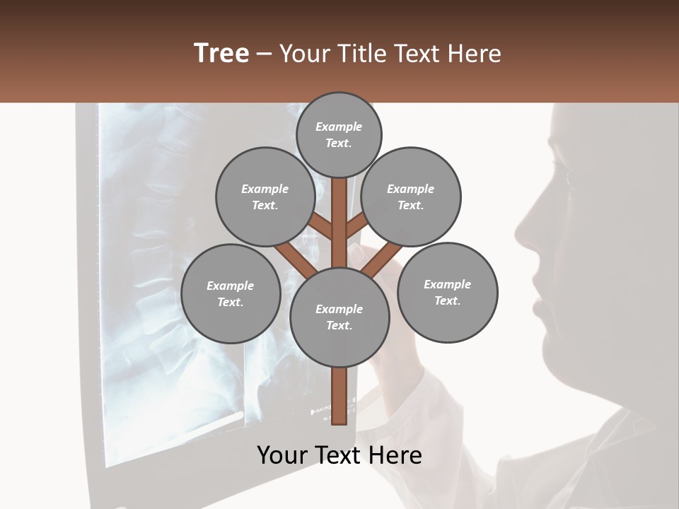 X-Ray Of The Spine PowerPoint Template