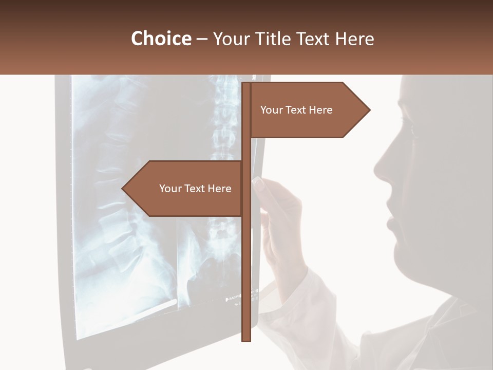 X-Ray Of The Spine PowerPoint Template