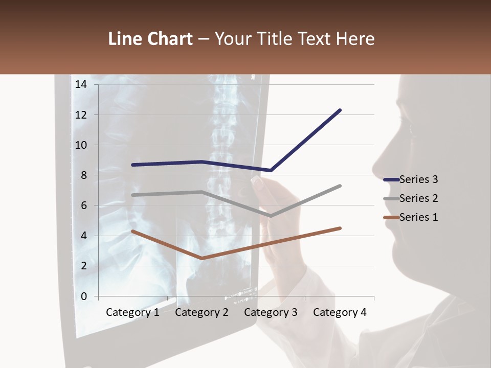 X-Ray Of The Spine PowerPoint Template