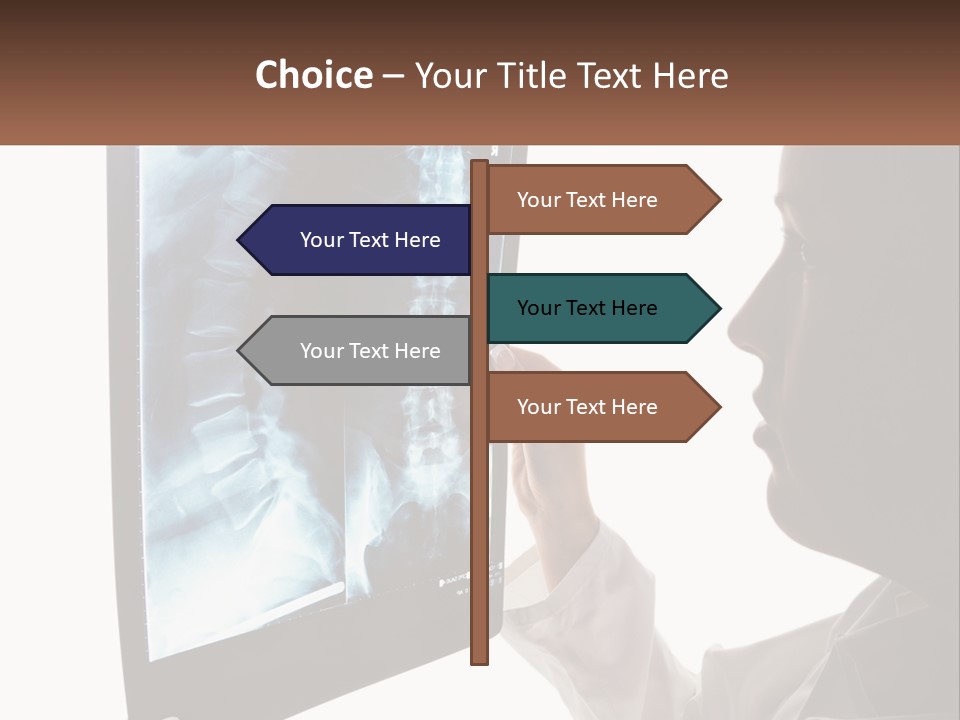 X-Ray Of The Spine PowerPoint Template