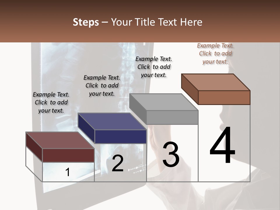 X-Ray Of The Spine PowerPoint Template