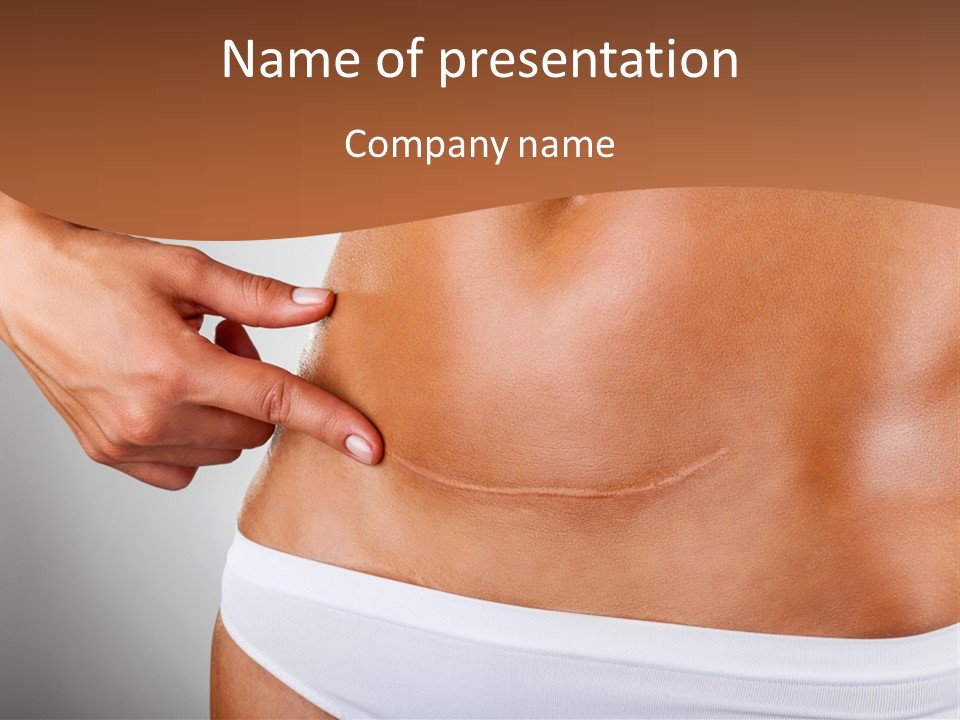 Scar From Surgery PowerPoint Template
