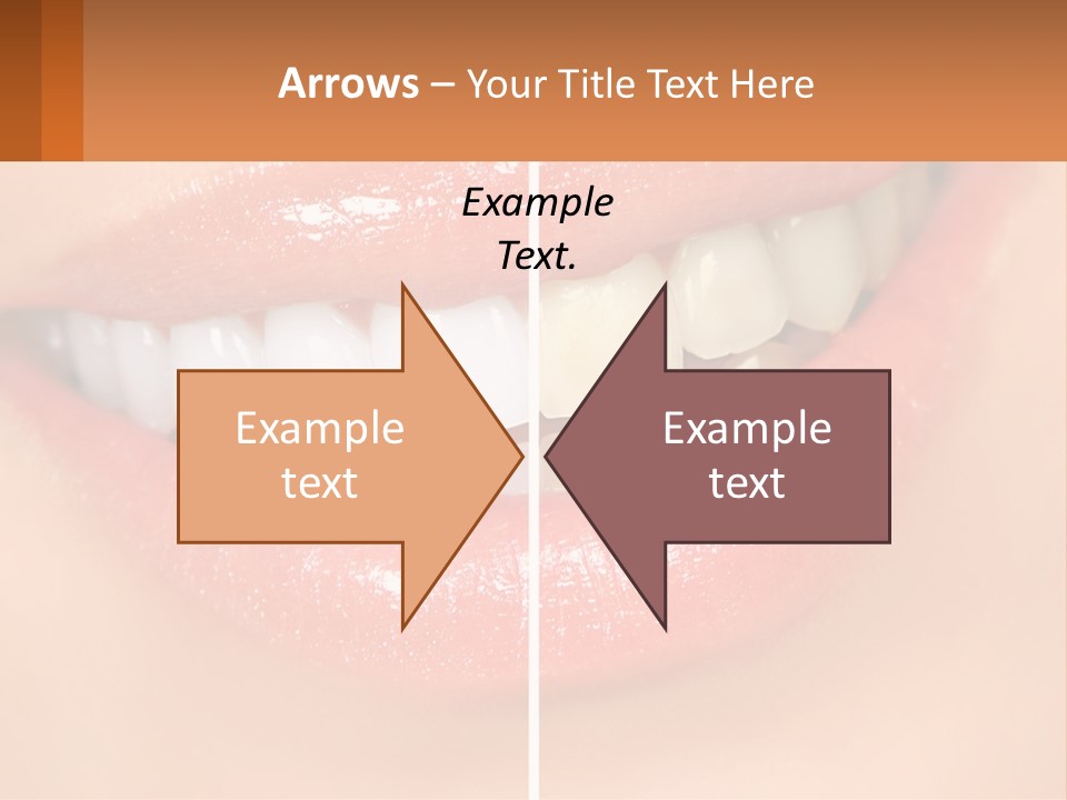Teeth Whitening PowerPoint Template