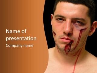 A Man With Blood All Over His Face PowerPoint Template