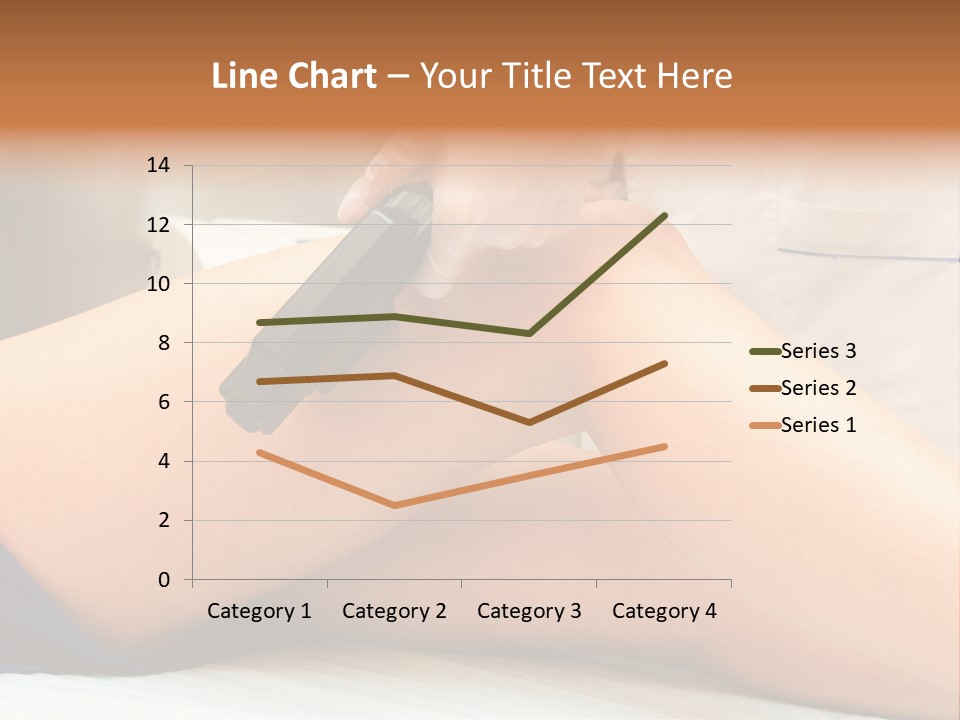 A Woman Getting A Laser On Her Leg PowerPoint Template