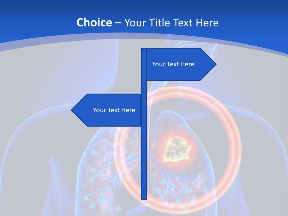 The Stomach Is Shown With A Red Circle Around It PowerPoint Template