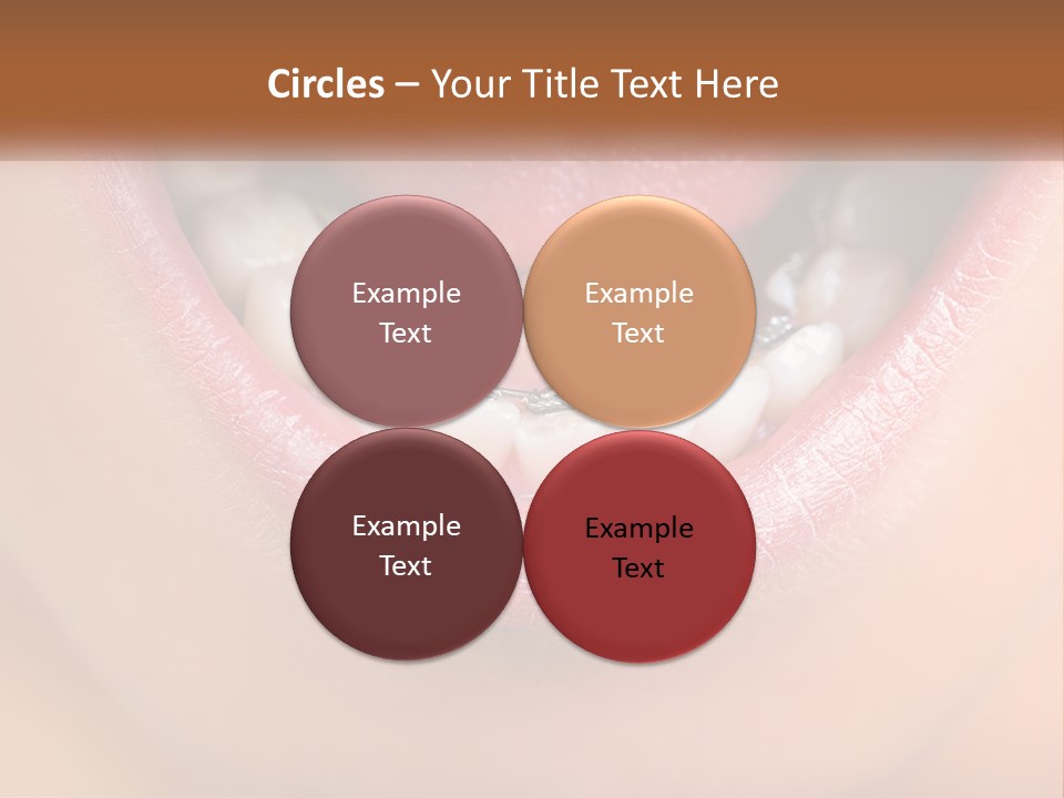 A Close Up Of A Person's Teeth With Braces PowerPoint Template