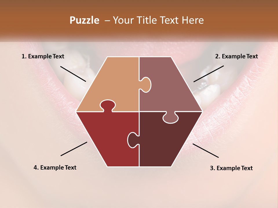 A Close Up Of A Person's Teeth With Braces PowerPoint Template