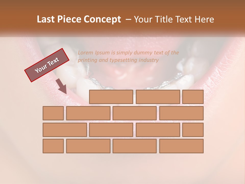 A Close Up Of A Person's Teeth With Braces PowerPoint Template