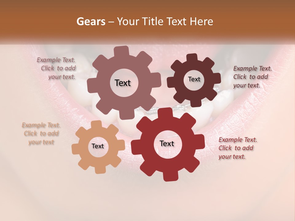 A Close Up Of A Person's Teeth With Braces PowerPoint Template