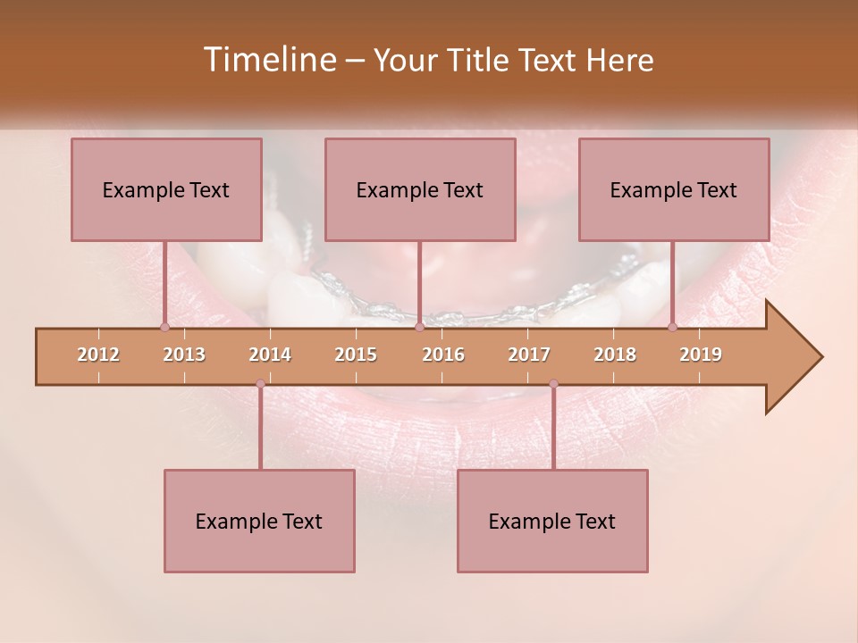 A Close Up Of A Person's Teeth With Braces PowerPoint Template