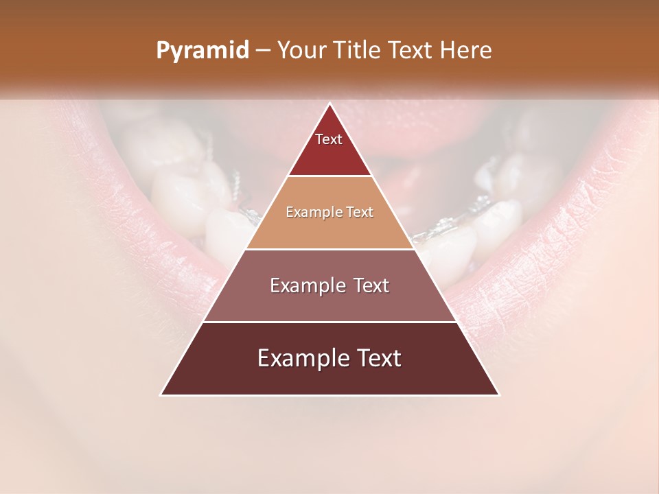 A Close Up Of A Person's Teeth With Braces PowerPoint Template