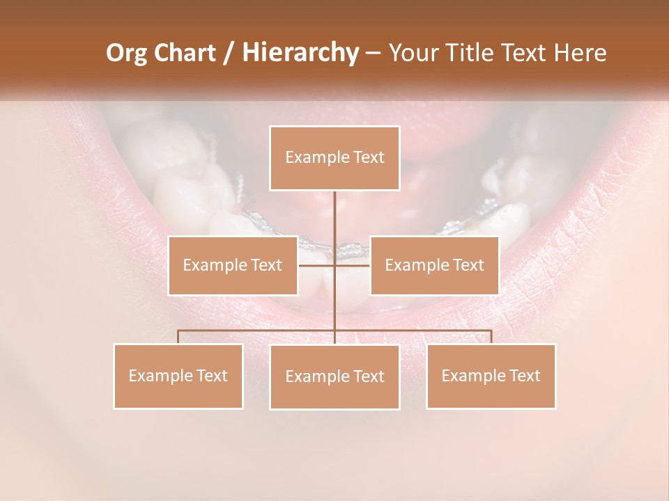 A Close Up Of A Person's Teeth With Braces PowerPoint Template