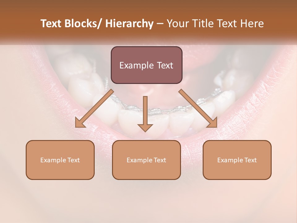 A Close Up Of A Person's Teeth With Braces PowerPoint Template